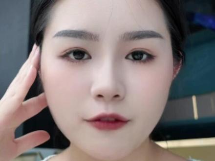 菲洛嘉135怎么搭配效果更强? 第一个实用搭配:
🔹 菲洛嘉135 + 基础水光(如透明质酸原液)混合机打
基础水光质地浓稠,能中和135的稀薄感,增强保湿力,还能防止漏药。这组特别适合干性肤质、初老型皮肤(20+人群),想要保湿+轻度抗老,闭眼入就行。
第二种组合:菲洛嘉135 + 修复水光 机打+滚轮导入
🔹 针对:敏感肌、红血丝、肌肤屏障差
菲洛嘉混合基础水光机打,之后用0.3~0.5mm滚轮导入含1% 及以上含PDRN成分的修复类水光,如氐殊或者普丽兰,修复+镇静+抗老三效合一。
第三种搭配:菲洛嘉135 +英诺小棕瓶 分层操作
🔹 针对:暗沉、想美白、提亮肤色的姐妹
注意:小棕瓶是酸性,菲洛嘉是碱性,混合注射会直接中和!所以必须分层:
菲洛嘉混合基础水光机打进真皮中层,英诺小棕瓶用滚轮在表皮浅层导入
这样抗老+提亮同步进行,层层递进不打架,效果加倍。
第四种组合:菲洛嘉135 + 三型胶原冻干纤维
🔹 针对:30+群体,胶原流失型老化肌,松弛、粗糙、细纹明显的肌肤
这组是抗老顶配:
菲洛嘉混合基础水光机打(深层),胶原蛋白冻干纤维可选择悦白之几或者薇旖美,用生理盐水稀释后,用滚轮浅层滚入(0.25~0.5mm)
也可以混合一起直接机打,但更推荐分层,安全性+效果更稳。
#菲洛嘉 #水光