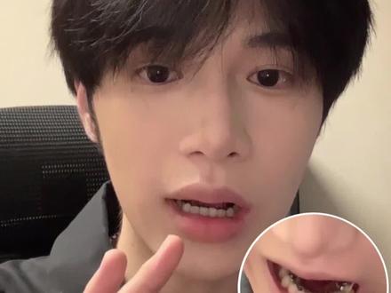 不注意这3⃣️点 整牙真的会变丑!!