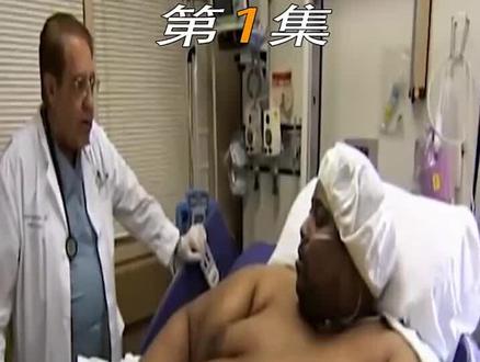 男子重达1000斤,把床都压塌了,为减肥,生生割去百斤肥肉"沉重人生 "减肥 #减肥 #减肥逆袭 #减肥减肥 #国外 #国外生活 #沙雕 #短片 #短片解说 #短片故事 #短片推荐 #解说 #解说纪录片 #医生 #痛苦的滋味 #减肥路上的绊脚石 #胖子