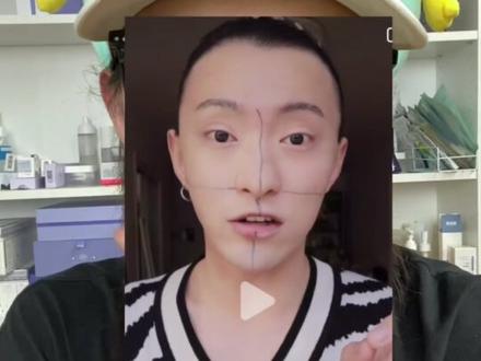 瘦脸针别乱打!做不好就会像我一样,脸垮脸凹!#瘦脸 #变美那些事 #变美 #do脸 #美容