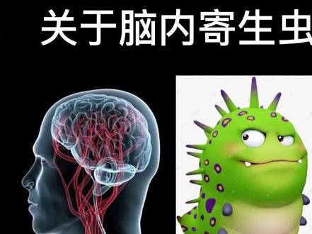 脑内较常见的寄生虫一裂头蚴。患者起病前多有食用生蛙肉、不洁鱼生或饮用野外生水史,食用半生不熟的蛙肉而感染。感染后容易出现头痛、肢体麻木乏力或者癫痫症状,往往需要开颅手术抓虫治疗。#颅内寄生虫#脑内寄生虫#脑内裂头蚴