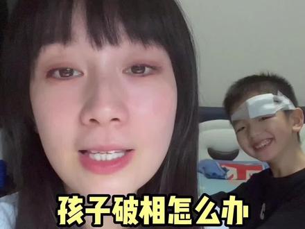 孩子发生意外,面部破相,千万不要缝针#孩子受伤 #开学 #儿童意外受伤 #美容胶 #校园安全