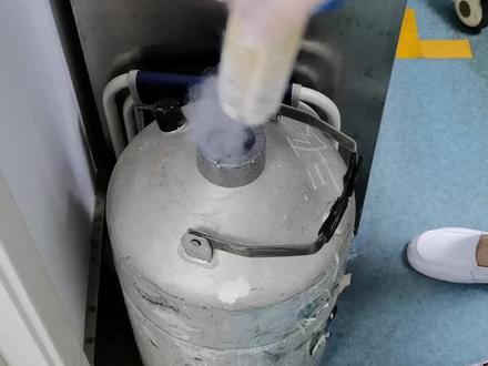 液氮冷冻治疗寻常疣#医学科普 #皮肤健康