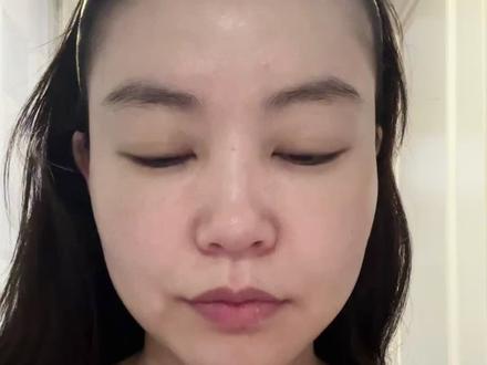 打卡 #凌博士次抛 第69天
#法令纹 #晚间护肤#玻尿酸#全分子玻尿酸