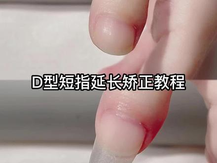 你们有遇到过这种大拇指吗?延长真是它的福音呀,赶紧收藏起来吧#异型甲 #d型短指 #新手学美甲
