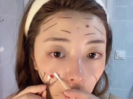 #闭口 #针清。针清手法讲解,有点粗糙随便看看吧,空了再说