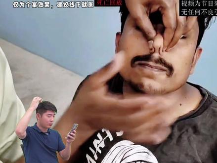 看了有种想试试的冲动。#抬头纹 #帽状腱膜 #鉴定专业视频