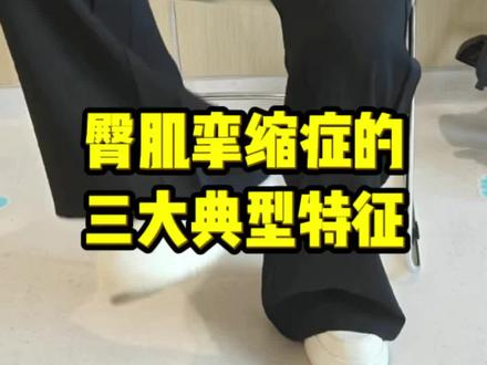 臀肌挛缩症三大核心典型特征
无法跷二郎腿:臀部肌肉紧张挛缩,双腿难以交叉叠加,始终无法正常翘起二郎腿。
无法并腿下蹲:双腿并拢时难以顺利下蹲,下蹲过程中膝盖会不由自主向外分开,无法并拢屈膝。
走路呈外八字步态:臀部肌群牵拉僵硬,日常走路双脚外撇,长期呈现外八字走路姿态。
#臀肌挛缩 #硬核健康科普行动 #抖出健康知识宝藏 #骨科袁锋 #医学科普