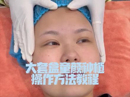 大套盒童颜种植操作方法教程#美业手艺人 #让我们一起变美 #逆龄抗衰