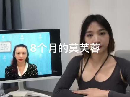 #高颅顶 #增加发量 发际线8个月的莫芙蓉,连#豆腐东 都没见过#小刚学长 #莫芙蓉