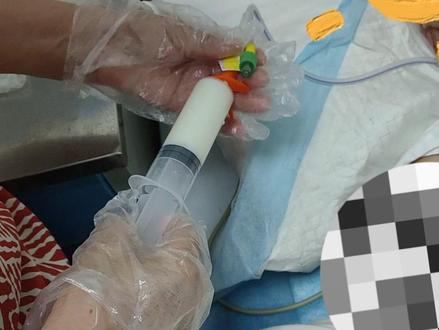 教护工阿姨学习如何进行鼻饲操作,简单来说就是如何通过胃管给患者注射食物,阿姨学的很快,操作上手也很快,点个赞👍。#鼻饲