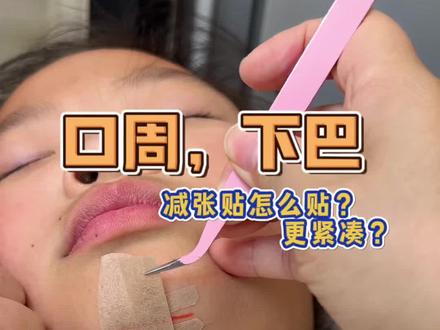 下巴部位减张贴怎么贴更紧凑?#减张贴#疤痕护理#伤口#减张贴什么时候用