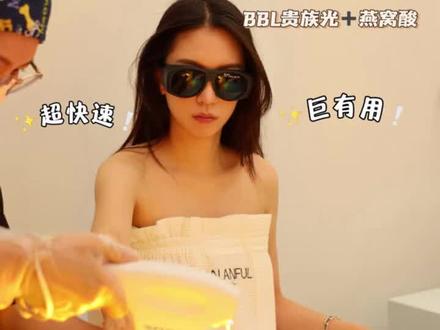 变白vlog | 都可以全身打光子了??
明星都在做的全身BBl光子白白项目!
前不久刚刷过一次就没有一起做
✍注意:
做完一定要防晒!
不要用功效性身体乳
不要去角质哦
#BBL #全身美白 #光子
