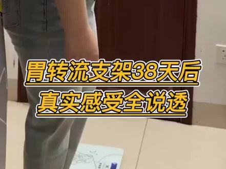 胃转流支架38天后真实感受!#胃转流支架 #胃转流支架 #胃转流手术 #减重