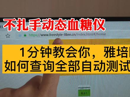 学起来,1分钟教会,不扎手动态血糖仪,查看自动记录的血糖值#糖尿病#健康生活#美食#减肥#运动降血糖