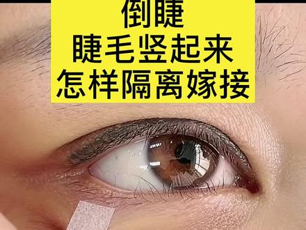 下睫毛倒睫直接竖起来怎样嫁接#睫毛 #美睫 #美睫培训