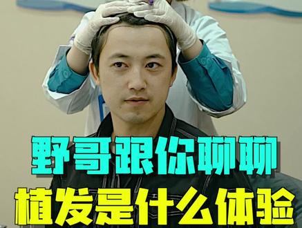 终于解决了我的头等大事,我的200万粉丝朋友们请好好爱护你们的头发吧!! #掉发 #拯救发际线 @疯产姐妹