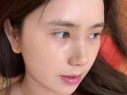 茜茜do鼻后续来啦!! #do鼻 #日常vlog #变美日记