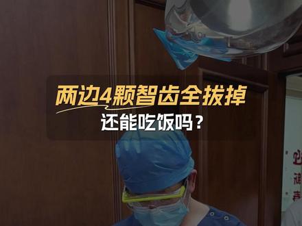 两边4颗智齿全拔掉,还能吃饭吗? #王佃灿 #智齿一定要拔吗 #四颗智齿一起拔
