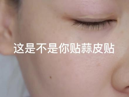 单眼皮,超级肿泡眼,内双必看双眼皮贴教程#双眼皮贴#单眼皮