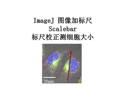#研究生 ImageJ绘制标尺scalebar,进行标尺校正测量细胞、物体大小