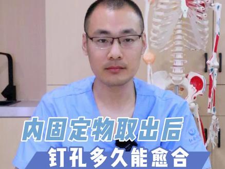 内固定物取出后,钉孔多久能愈合#骨科路遥 #医学科普 #医学知识科普 #健康科普 #医者仁心