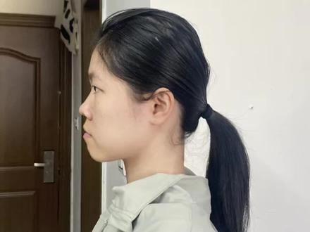 扁头逆袭之圆头低马尾
一根皮筋,一分钟搞定,扁头发量少细软塌,总是扎不好低马尾,来看看这期视频!
声明这个发型我不是每次都能扎出这么圆润饱满的效果,一般来说,如果我洗头的时候用了护发素和精油,这个脑壳就没这么饱满,因为是细软塌,用了护发素之后头发比较柔顺一些,后面又有发缝,所以扎起来把头发扯松的时候发缝就非常明显的露出来,且细软塌没有支撑在脑袋上没多久就会扁塌凌乱了。
细软塌若想将此头发成功扎好有以下3点:1️⃣不涂护发素或者精油(因为我的头发之前是全头烫坏了,目前留了一年多的时间,上半部分的头发还有烫坏,是能够达到一定的支撑作用,健康头发细软塌不一定能够做到这样的效果)2️⃣用玉米夹把脑后的头发夹蓬松3️⃣卷头发
大家快拿起你手中的发圈试一试吧
#低马尾 #扁头 #发型教程 #发型分享 #头绳