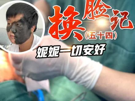 今日分享:兽皮痣女孩妮妮换脸记(54)#胎记 #兽皮痣