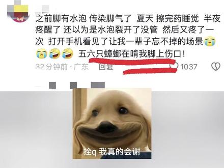 你被蟑螂咬过吗#蟑螂大战 #咬人的蟑螂
