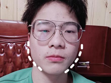 你不是胖了?而是发腮了!