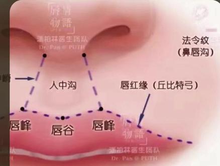 唇形模糊,没有唇峰,如何打造精致的M唇? #m唇 #唇形设计 #唇部整形 #口周年轻化