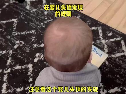 在婴儿头顶发旋发现的规则