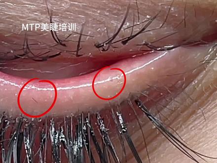 接完睫毛眼睛难受的其中一个原因,很难被发现喔!#MTP美睫培训