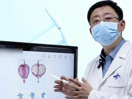 查出前列腺钙化灶,意味着什么?#健康科普 #男性健康 #健康 @泌尿外科杜医生