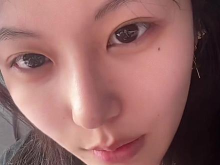千万不要打 #替西帕肽 减脂圈容易有攀比心理,会刻意弱化自己的不适,只说优点,大家理性看待,人都是血肉之躯 没有任何无副作用的产品!用久了也完蛋(没有怀过生小孩 我19岁恶意揣测评论追着骂)