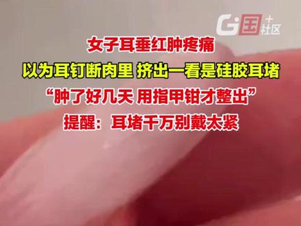 2月14日(采访时间),安徽合肥。女子耳垂红肿疼痛,以为耳钉断在肉里,挤出一看是硅胶耳堵:用指甲钳才取出,太疼了。提醒大家,耳堵千万别戴太紧。