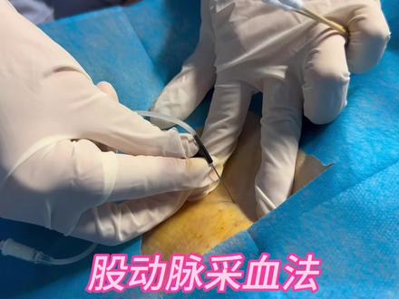 今日分享股动脉采血法详细版,需要的小伙伴们点赞收藏呦~#护士懂护士 #股动脉采血 #股动脉 #实习护士 #护士
