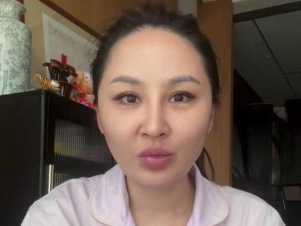 溶脂、蓉芷,1个月恢复分享
#溶脂 #蓉芷 #溶脂针 #馒化 #馒化脸