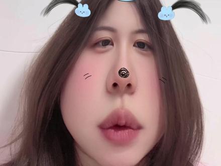 #孕晚期 孕晚期记得检查“b族链球菌”#孕期检查 #怀孕那些事