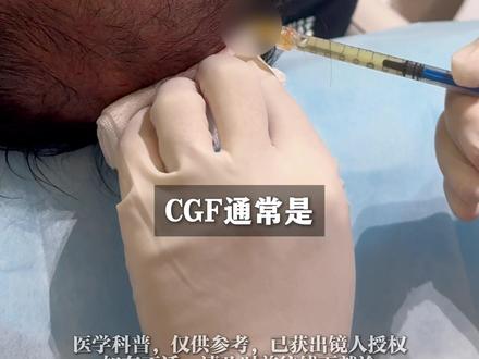 CGF要打几次?才能看到效果 #CGF #雄脱 #脱发#毛囊再生 #广州植发苗勇