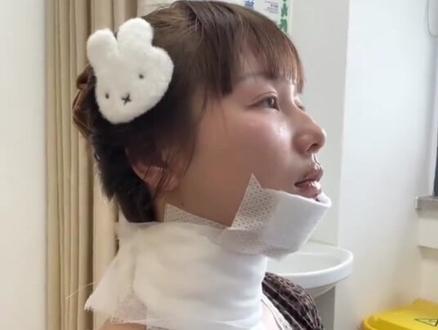 演员生日蛋糕喷火被烧伤#喷火蛋糕 #网红跟风 #烧伤事故 #演员生日蛋糕喷火被烧伤