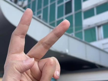 被松鼠下死口咬了以后怎么办?多久才能好??要不要打疫苗?#红腹松鼠 #松鼠#咬人 #狂犬疫苗 #蜜袋鼯