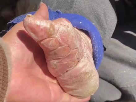 省流:古代女人的三寸金莲,是如何形成的!#三寸金莲 #裹小脚 #奇人异事 #猎奇 #裹脚