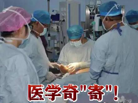 不是科幻!是医学奇“寄”!#女子左耳离断在脚背寄养5个月移回头上 多亏血脉相似!实现罕见“异位寄养”