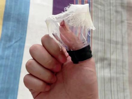 手指头受伤的应急处理方式#受伤 #理想