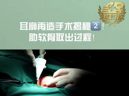 耳廓再造手术揭秘2,肋软骨取出过程!#健康
