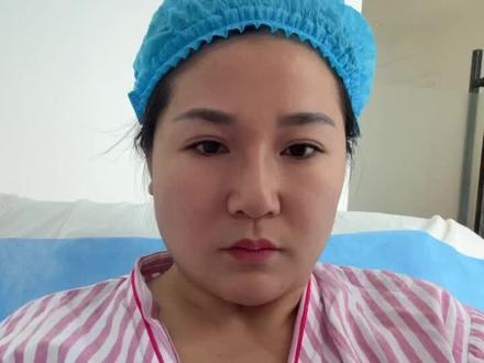 刚做完🐻出来,我做的300cc
#假体#隆胸术后真实分享