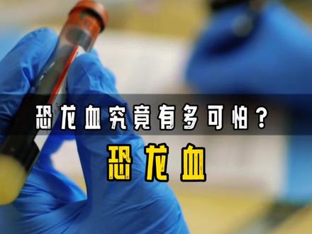 恐龙血究竟是什么?它到底有多可怕?比熊猫血还稀有,全国仅百人 #恐龙血 #热点小助手 #涨知识 #人物故事