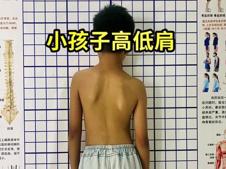 #体态纠正 #高低肩 #脊柱侧弯 如果高低肩比较严重的话,建议线下找专业机构进行一对一的指导训练