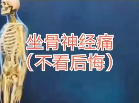 认识坐骨神经,医学科普,仅供参考。